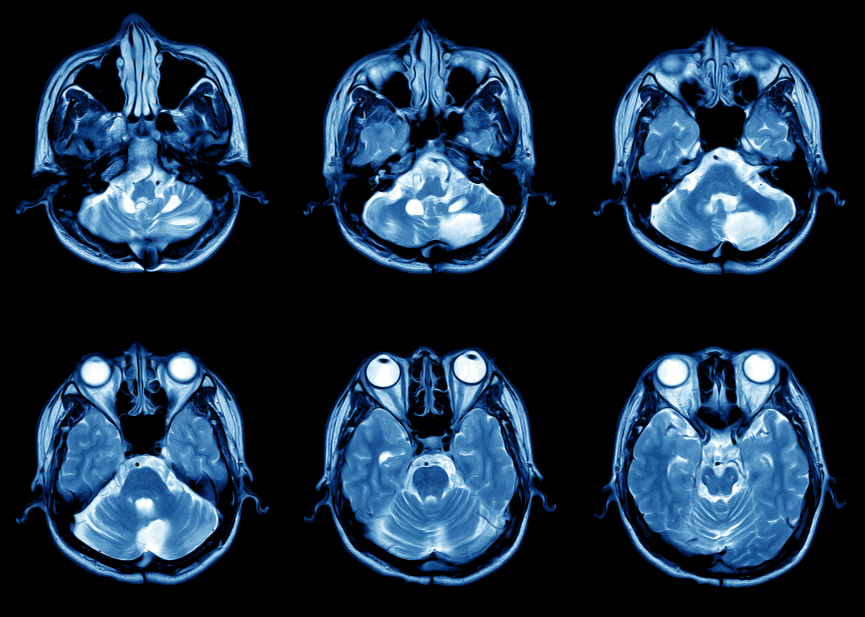 Open OPEN MRI (Magnetic Resonance Imaging) - Winchester Imaging