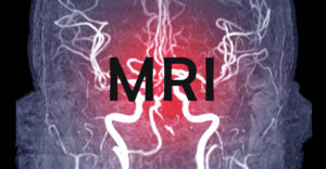 MRI